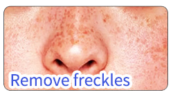 BA-FC23 removal freckles