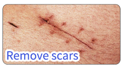 BA-FC23 removal scars