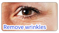 BA-FC23 removal stretch wrinkles