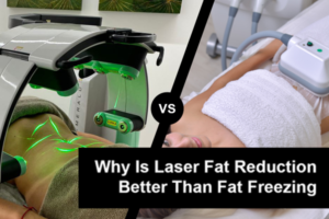 Emerald laser VS fat freezing machine