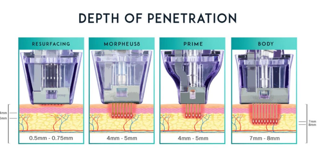 microneedle fractional machine deepth of penetration