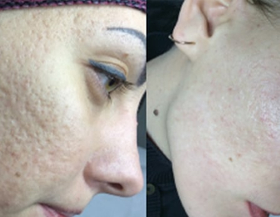 face before after