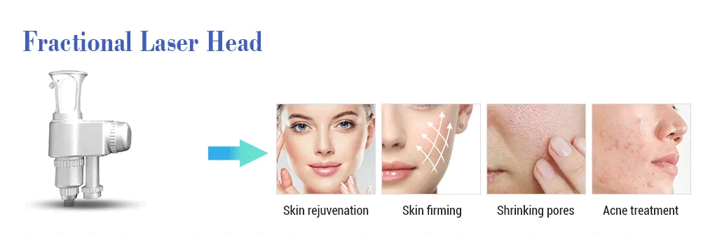 BA-fc21 fractional laser head