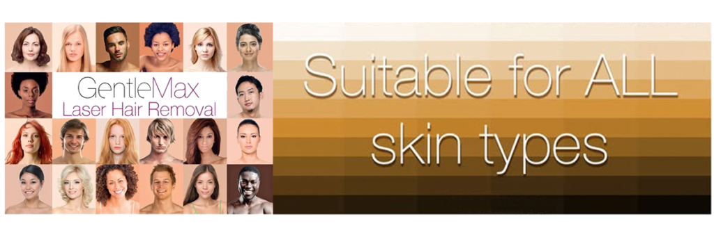 alexandrite laser machine