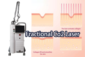 fractional co2 laser machine