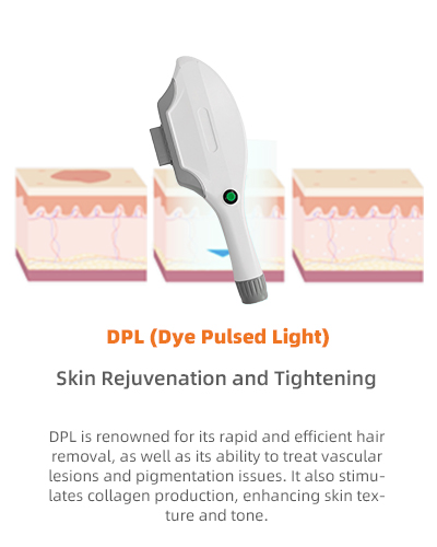 ipl laser