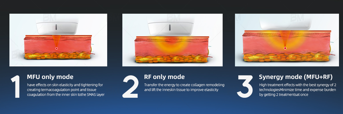 mfu model 3