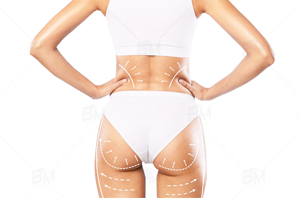 skin tightening