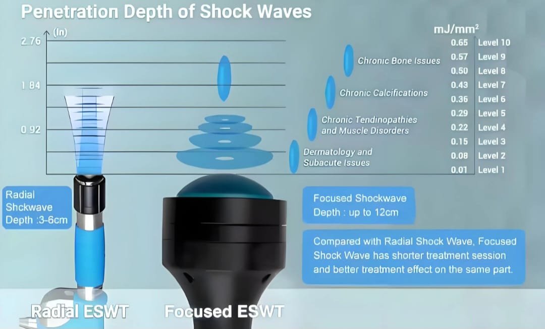 BA-SW27 Focused shockwave machine
