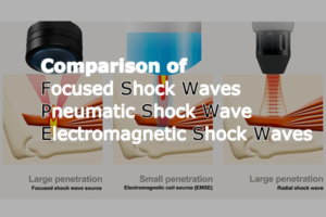 Comparison-of-shock-wave-technology