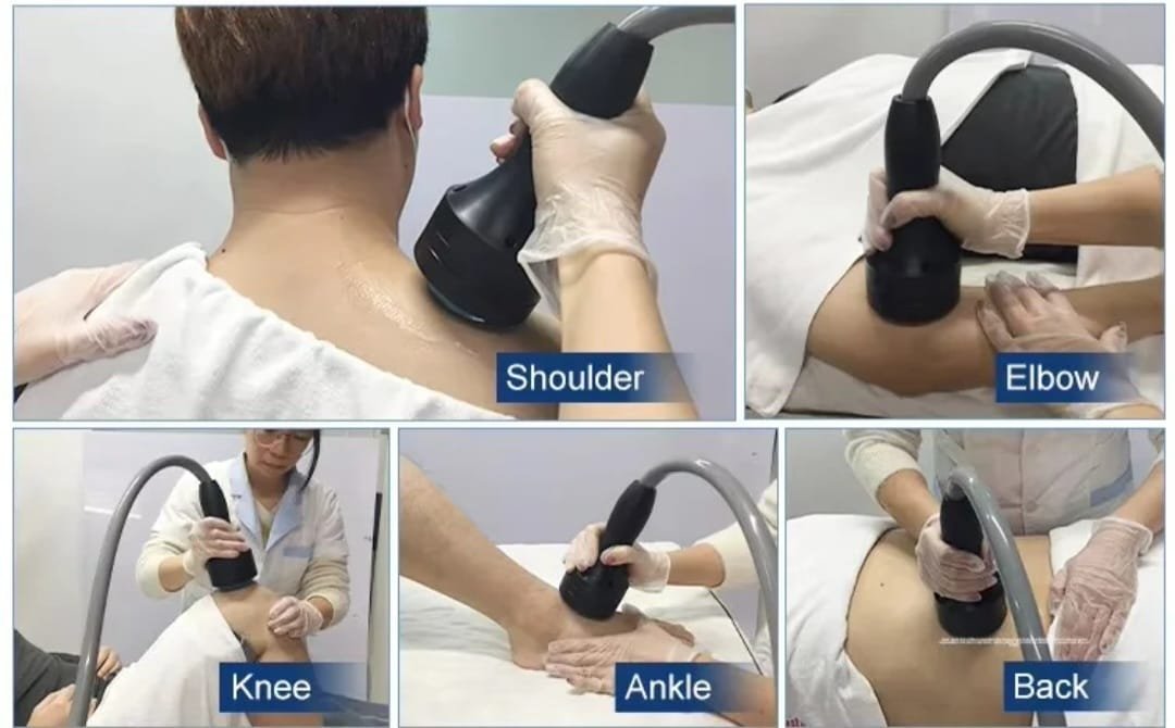 Focused-Shockwave-Therapy-Pain-Relief-Machine-2