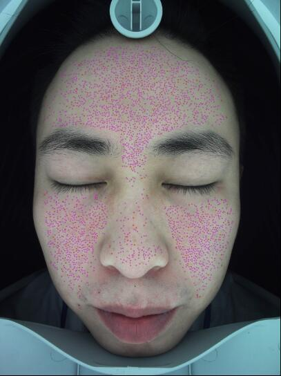 RGB PORE