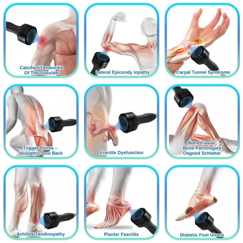 Simple -Focus softwave Therapy Machine
