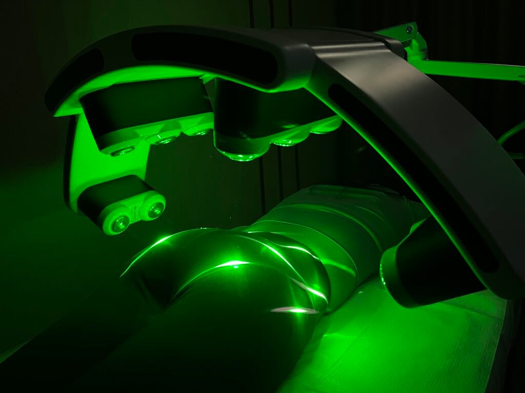 emerald laser machine treatment