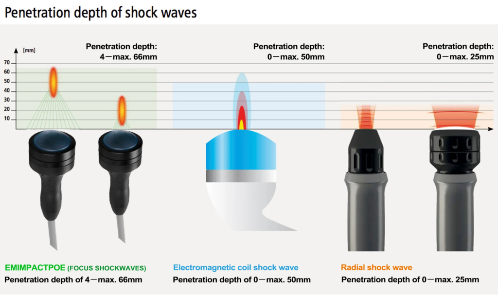 shockwave machine compare
