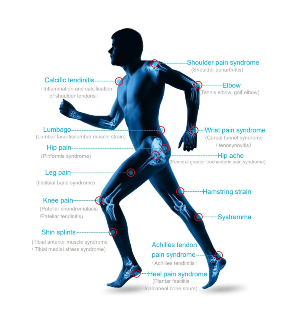 shockwave machine indications