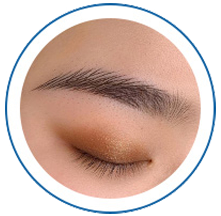 Eyebrow Washing,removal of tattoos, birthmarks