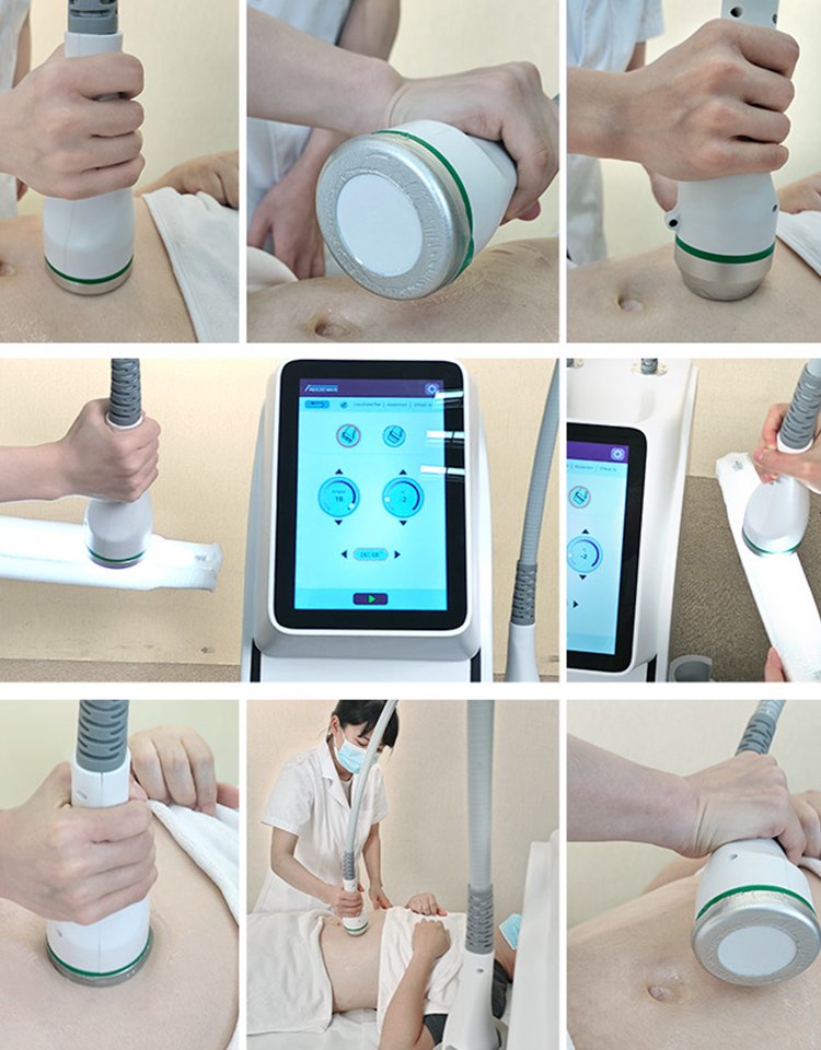 ba-cw22 freezewave coolwave