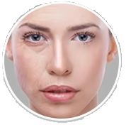 wrinkle removal