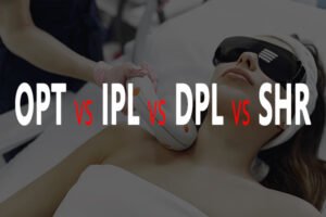 OPT, IPL, DPL, and SHR (article)