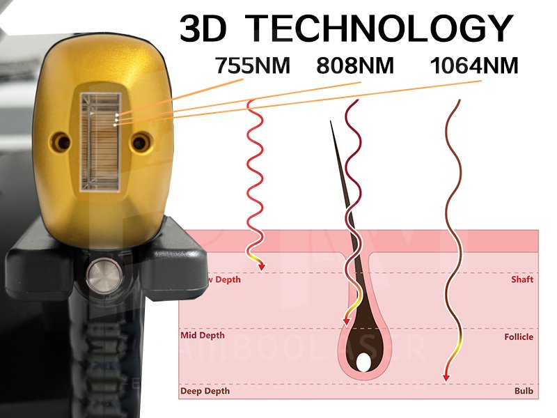 soprano titanium 3D technology