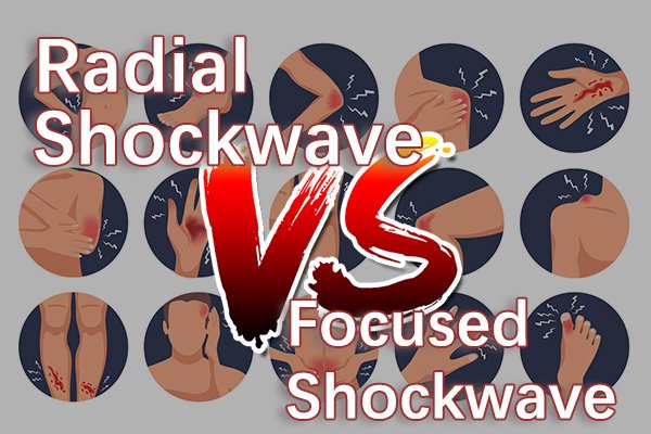 radial shockwave vs focused shockwave