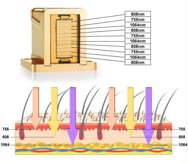 soprano titanium ice laser hair removal machine principle