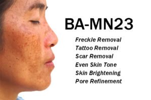 From tattoo removal to acne scar repair