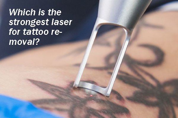 Which is the strongest laser for tattoo removal