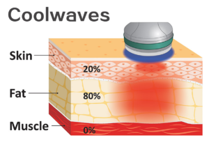 coolwaves machine principle