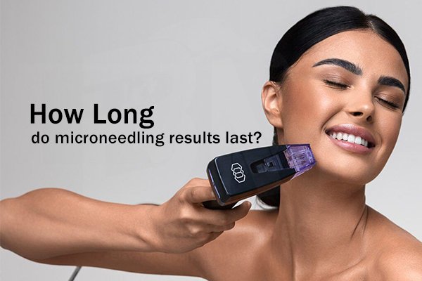 how long do microneedling last