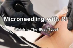 microneedling with rf which is the best type