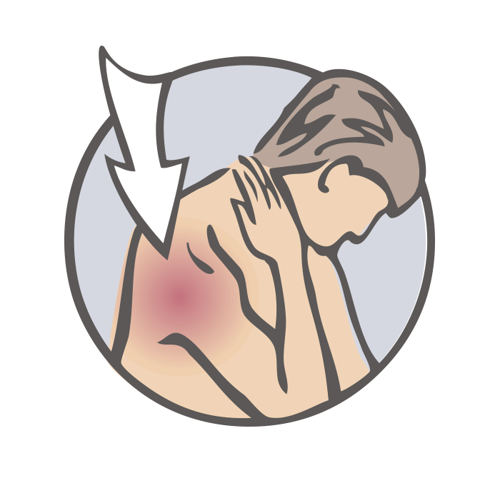 bamboolaser focused shockwave