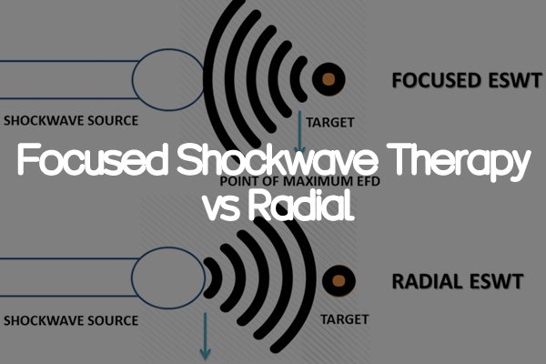focused shockwave therapy vs radial