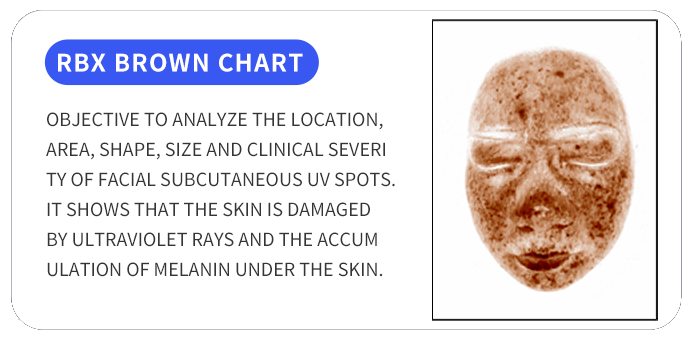 BA-AN23 Skin ananlysis machine data