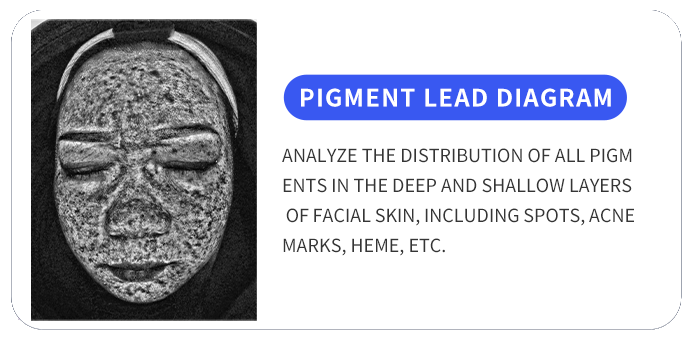 BA-AN23 Skin ananlysis machine data