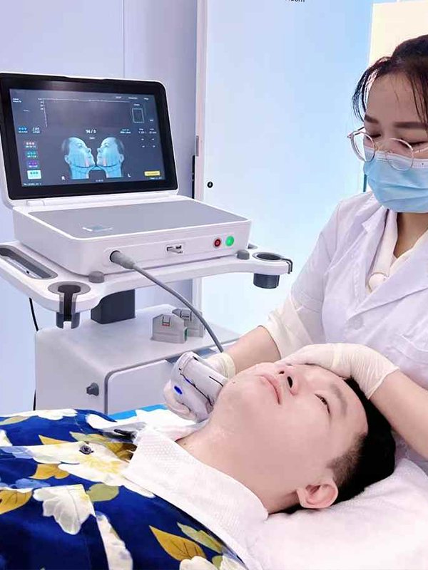 ba-hf36 hifu machine face skin tightening treatment