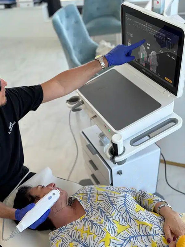 ba-hf36 hifu machine facial treatment