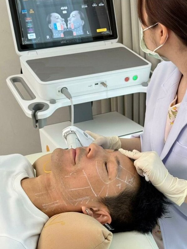 ba-hf36 hifu machine treatment