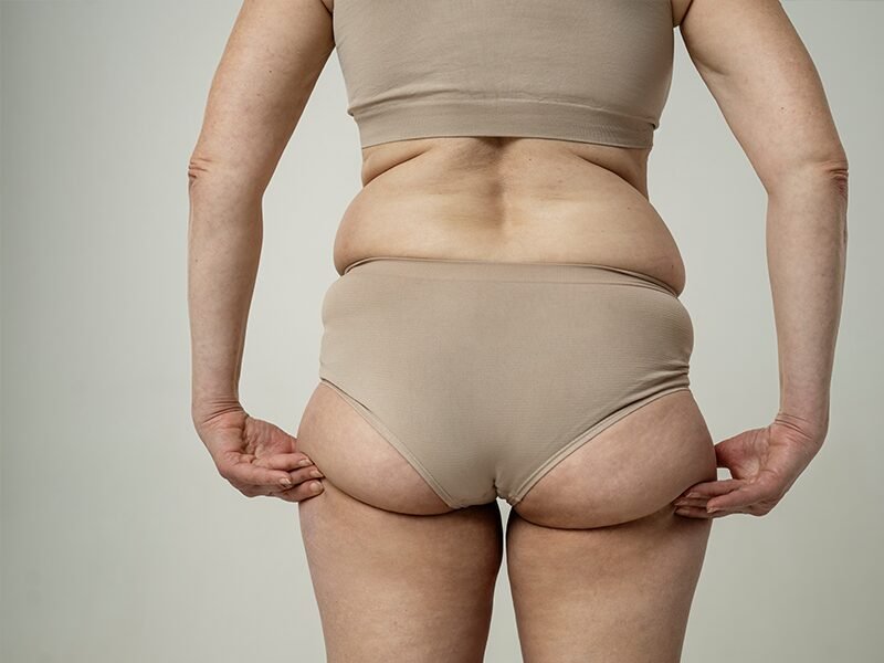 ba-lr22 buttock stubborn fat removal