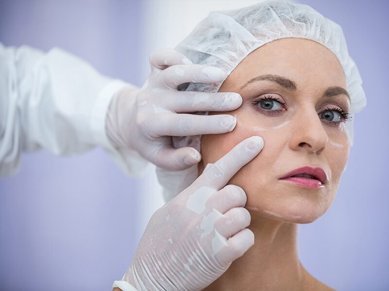 ba-lr22 face lifting