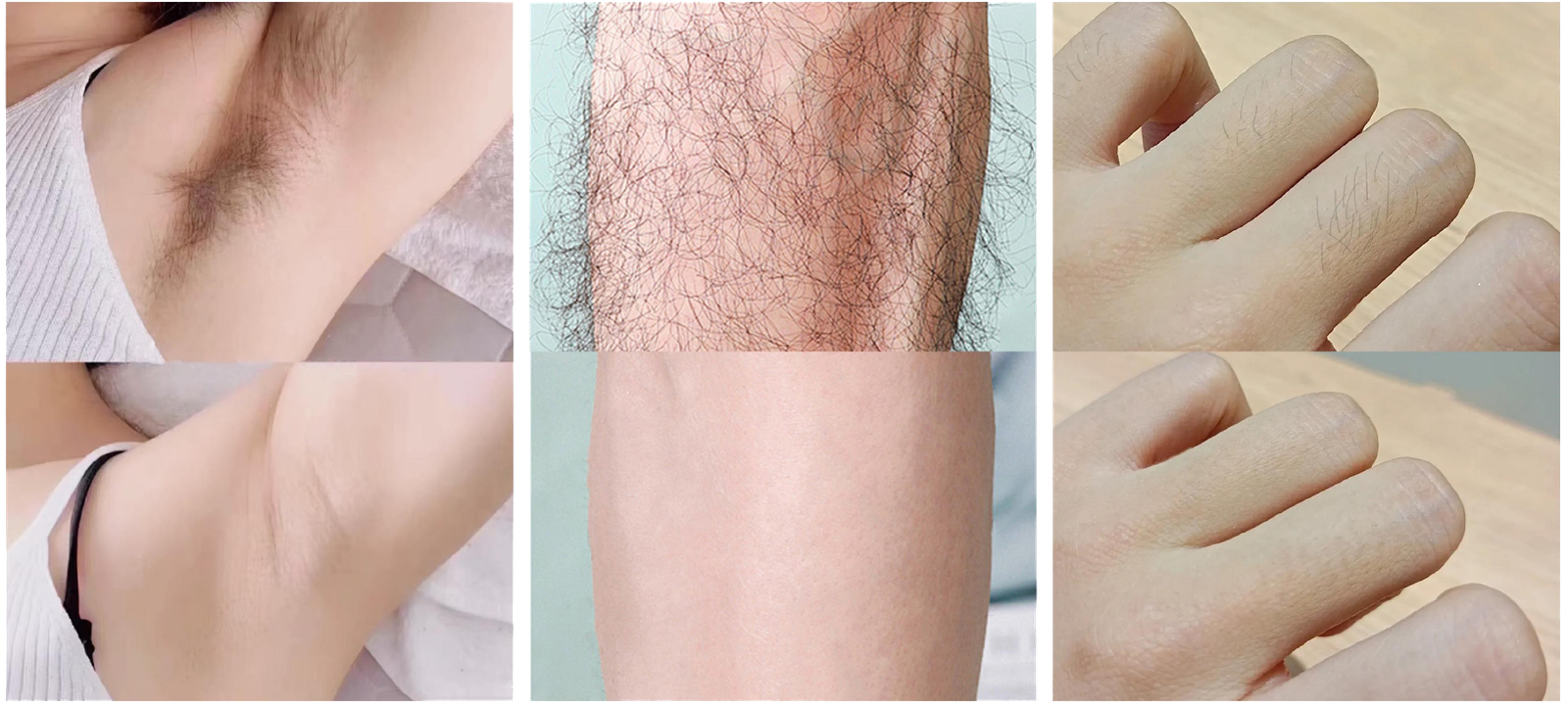 ba-mf27 before after