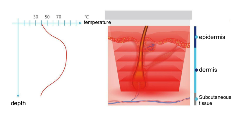 ba-mf27 laser machine principle