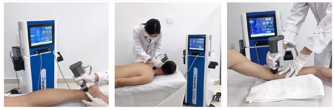 ba-sw35 therapy display (1)