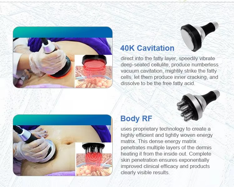 ba-cr23 cryo fat freezing machine working handles