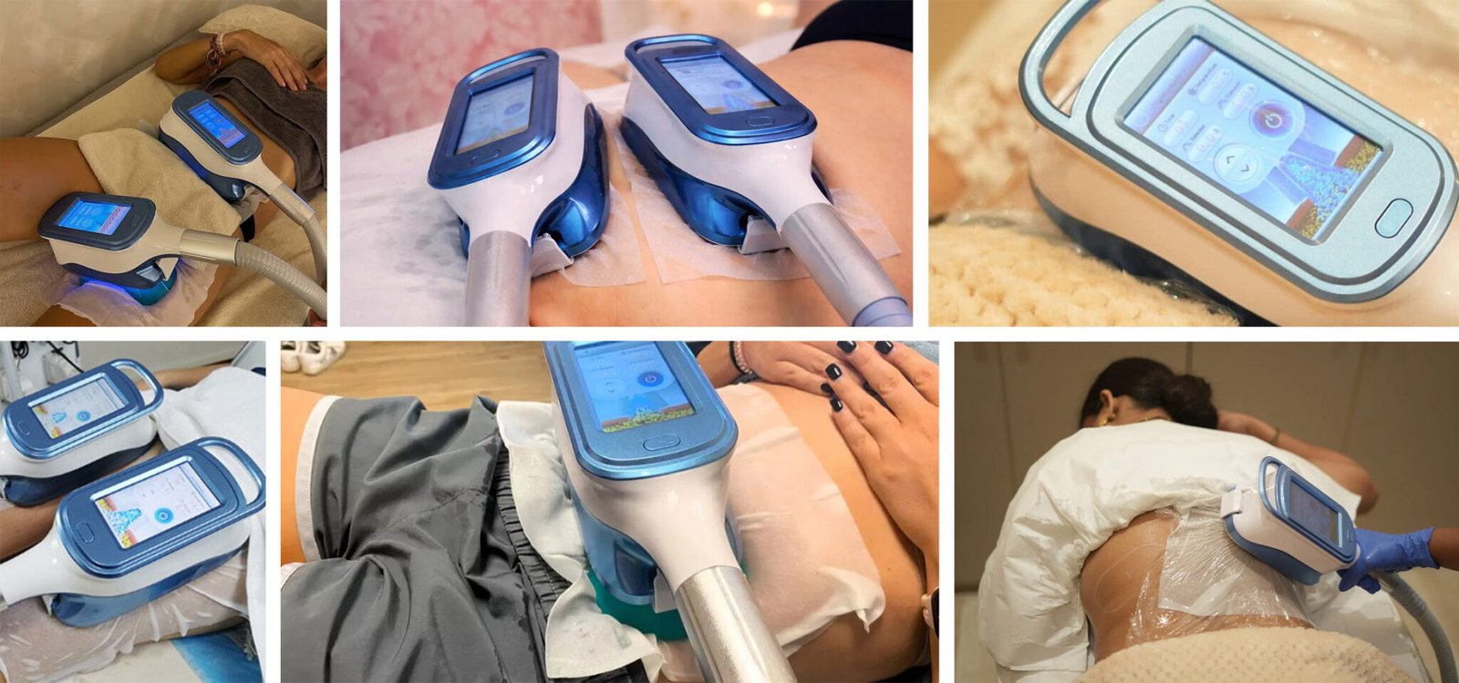 ba-cr28 fat freezing treatment