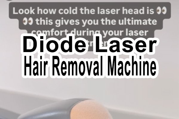 diode laser hair removal machine