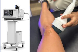 BA-SW30 FAQ