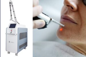 Breaking down the differences between Nd: YAG, Q-switched Nd: YAG, and picosecond lasers