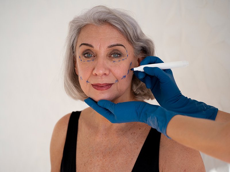 Collagen stimulation, anti-wrinkle treatment, and skin rejuvenation